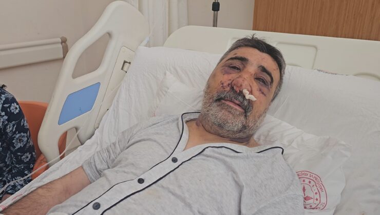 İngiliz boksörün darbettiği taksici konuştu