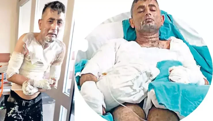 ‘Neden beni şikayet ettin?’ diyerek hayatını yaktılar